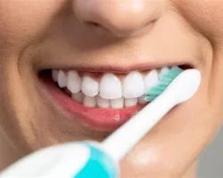 تبييض الأسنان