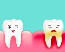 التهاب اللثه